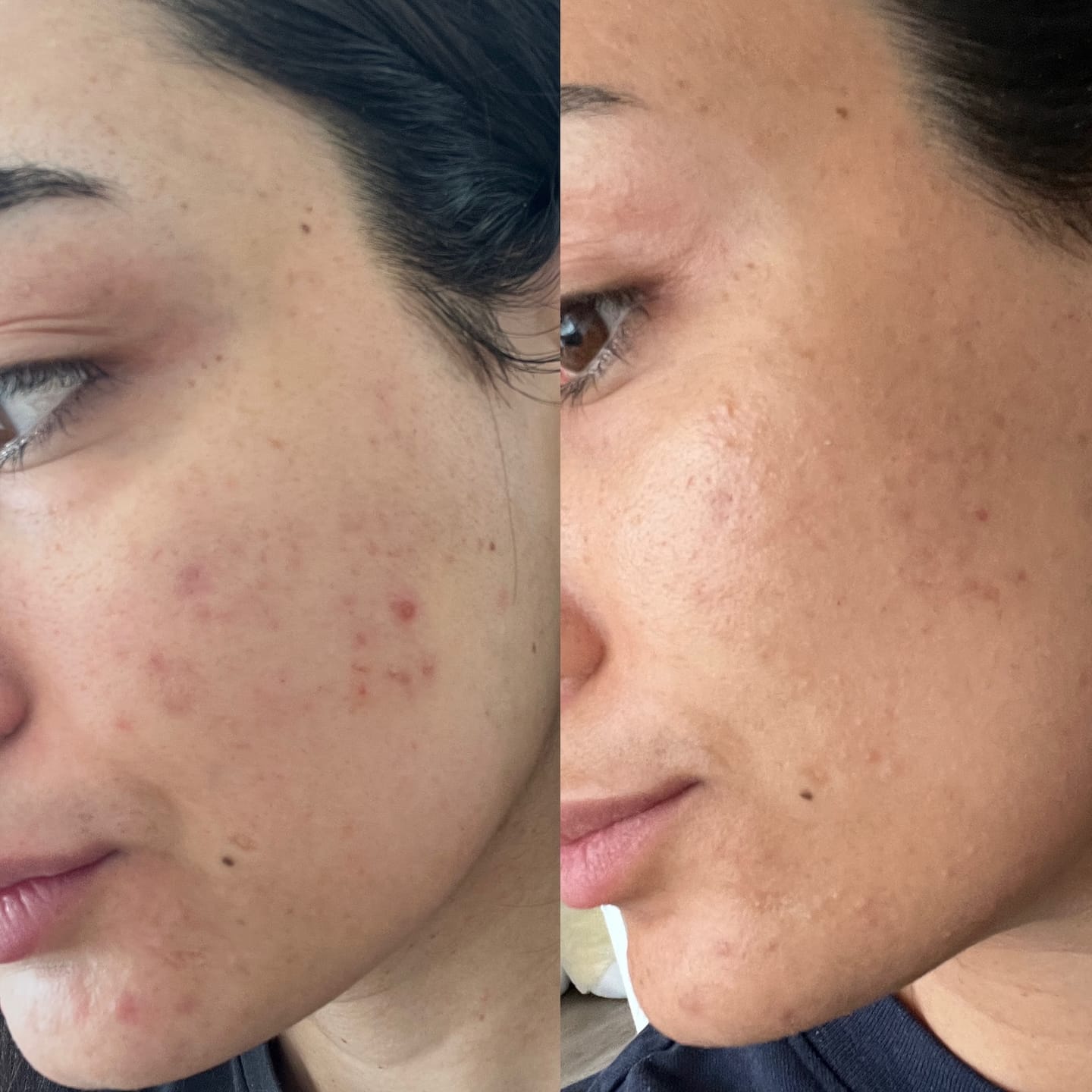 Crema Facial Purificante