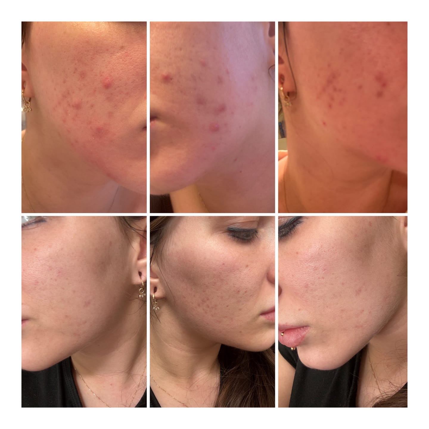 Crema Facial Purificante