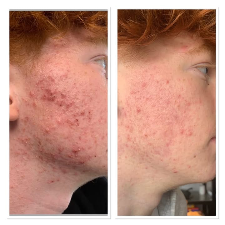 Crema Facial Purificante